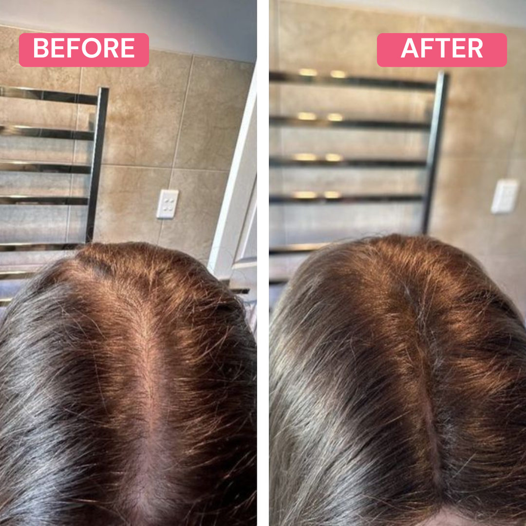 Tona Hairline Powder