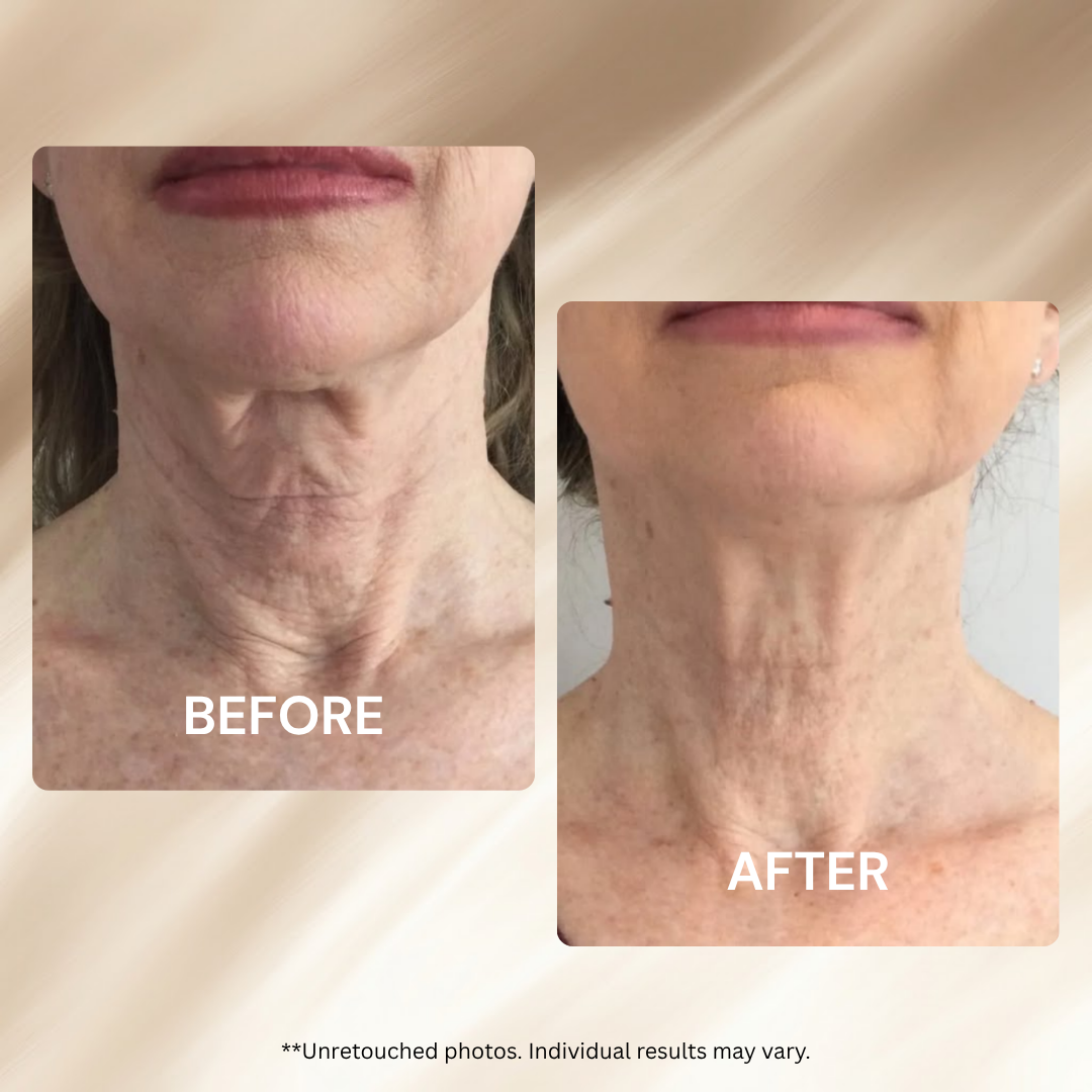AH-8 Firming Neck Cream Moisturizer anti Aging Smoothing Wrinkles Electric Massage Polypeptide Eye Cream Eye & Neck Skincare Set