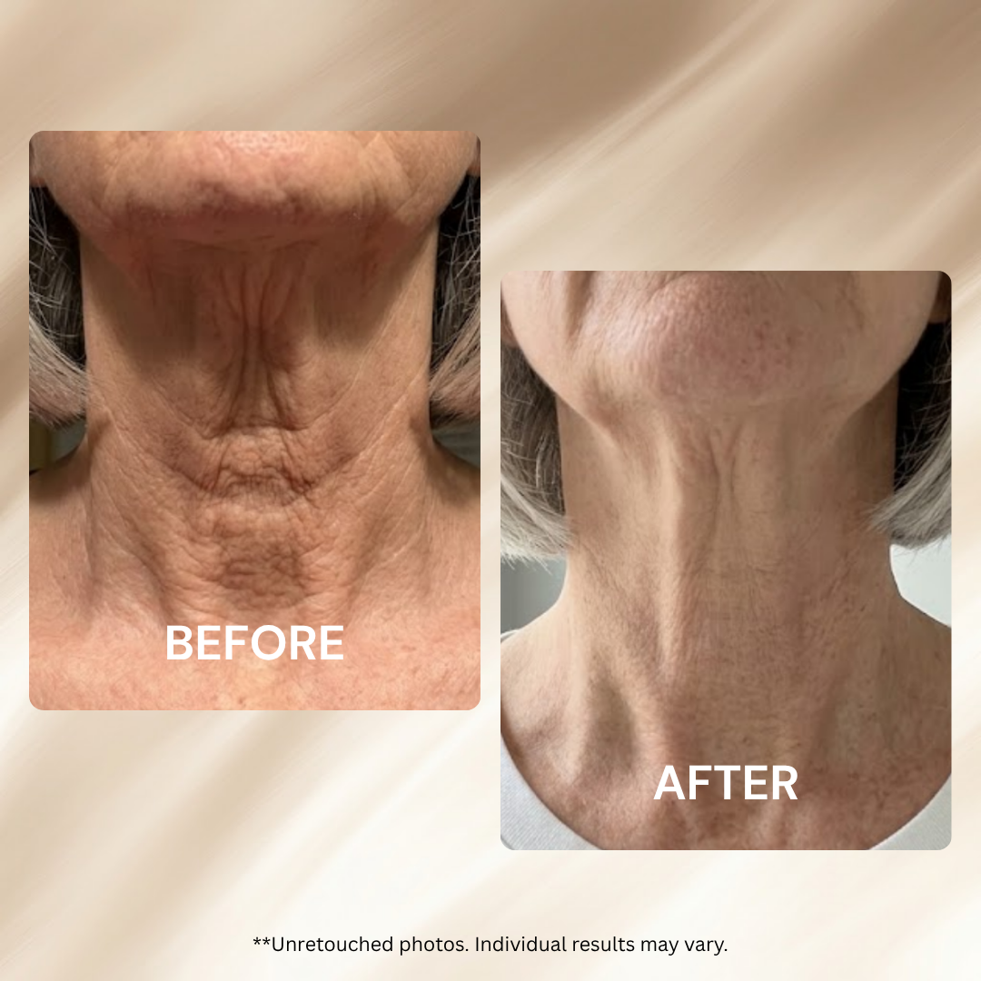 AH-8 Firming Neck Cream Moisturizer anti Aging Smoothing Wrinkles Electric Massage Polypeptide Eye Cream Eye & Neck Skincare Set